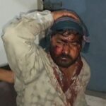 दर्जनों हमलावरों ने धारदार हथियारों से युवक पर किया जान लेवा हमला